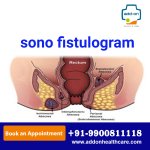 sono fistologram.jpg