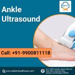 Ankle Ultrasound.jpg