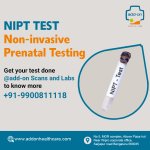 nipt test.jpg