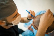 hair Transplant & Is Hair Transplant Surgery a Safe Procedure.jpg