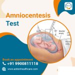 Amniocentesis.jpg