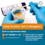 Urine Routine Test in Bengaluru.jpg