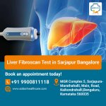 Liver Fibroscan Test in Sarjapur Bangalore.jpg