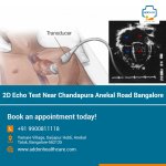 2D Echo Test Near Chandapura Anekal Road Bangalore.jpg